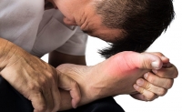 5 cách cắt cơn đau gút cấp cực nhanh, cực hiệu quả